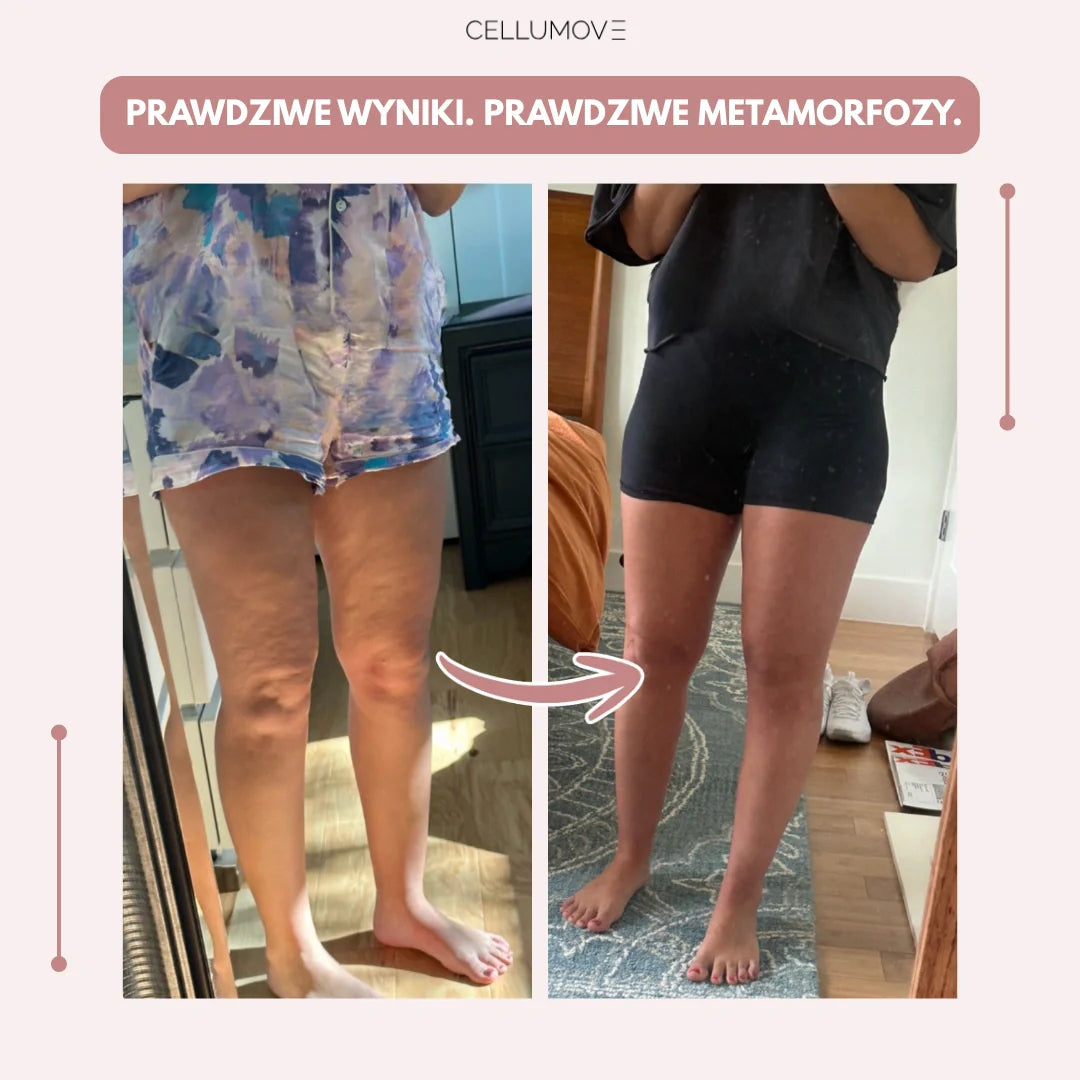 Cellumove 3D Legginsy – Pożegnaj się z bólem i wystąpieniem ekstremalnym w naturalnym sposobie