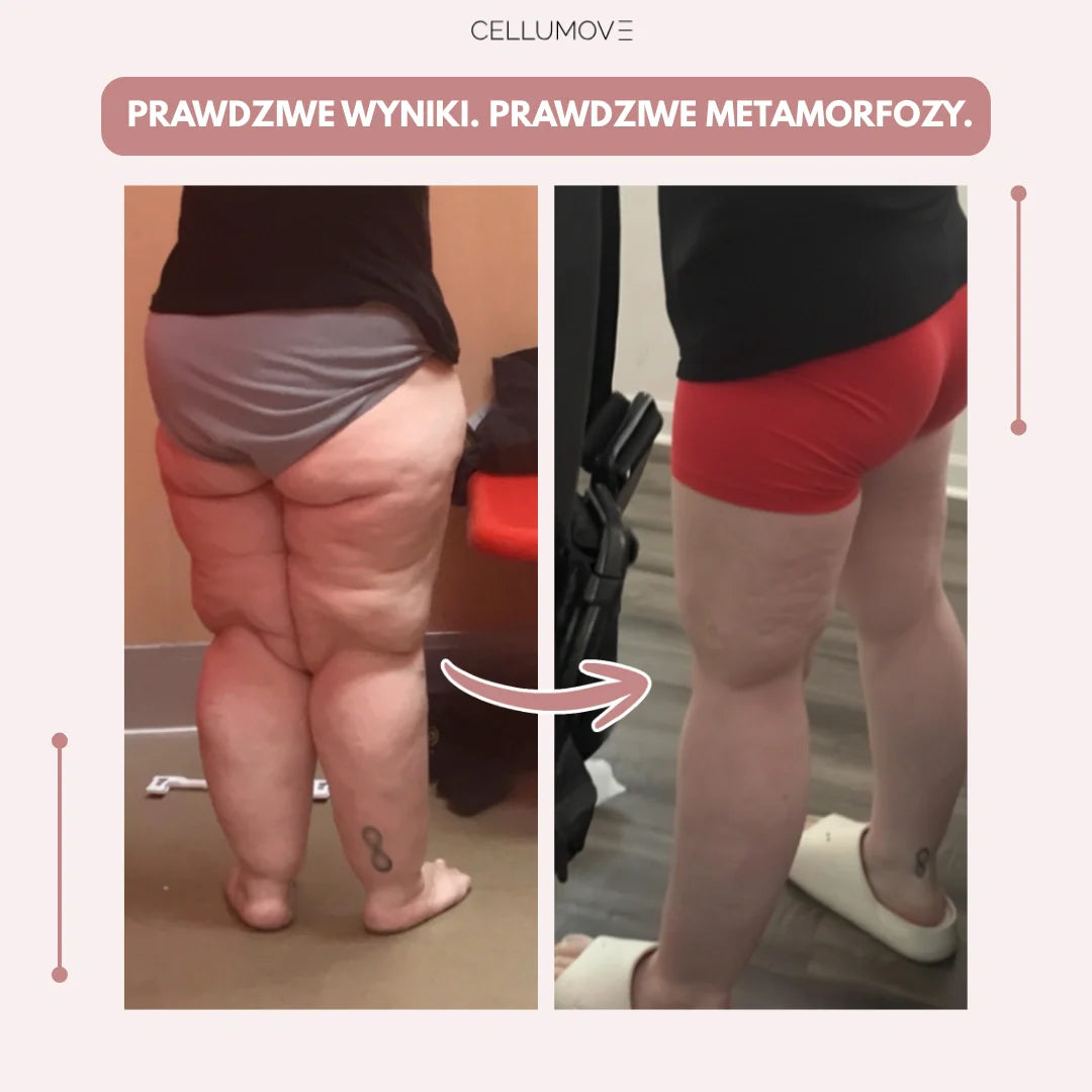 Cellumove 3D Legginsy – Pożegnaj się z bólem i wystąpieniem ekstremalnym w naturalnym sposobie