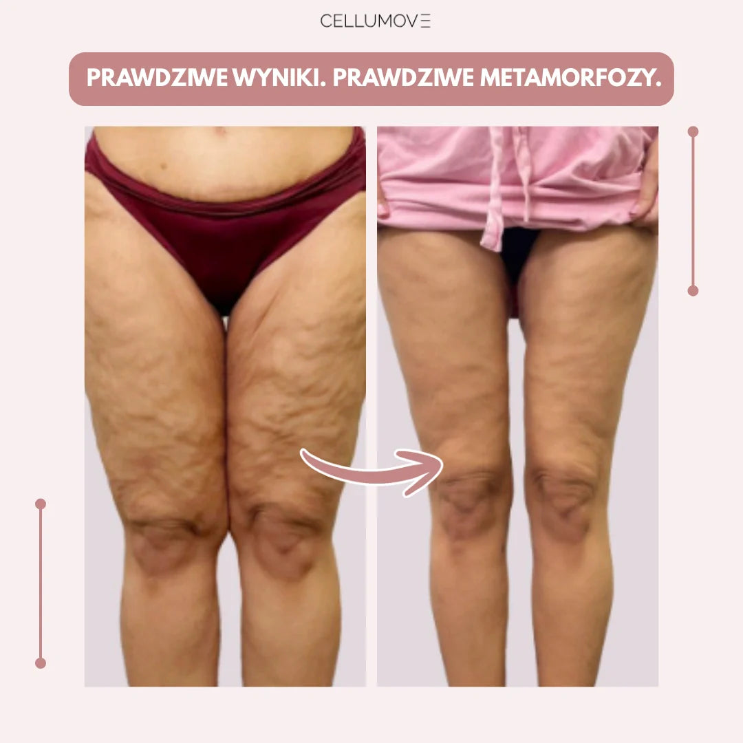 Cellumove 3D Legginsy – Pożegnaj się z bólem i wystąpieniem ekstremalnym w naturalnym sposobie