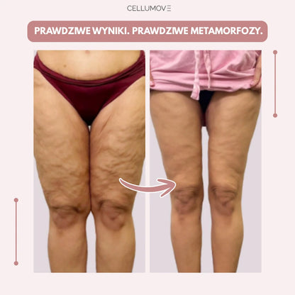 Cellumove 3D Legginsy – Pożegnaj się z bólem i wystąpieniem ekstremalnym w naturalnym sposobie