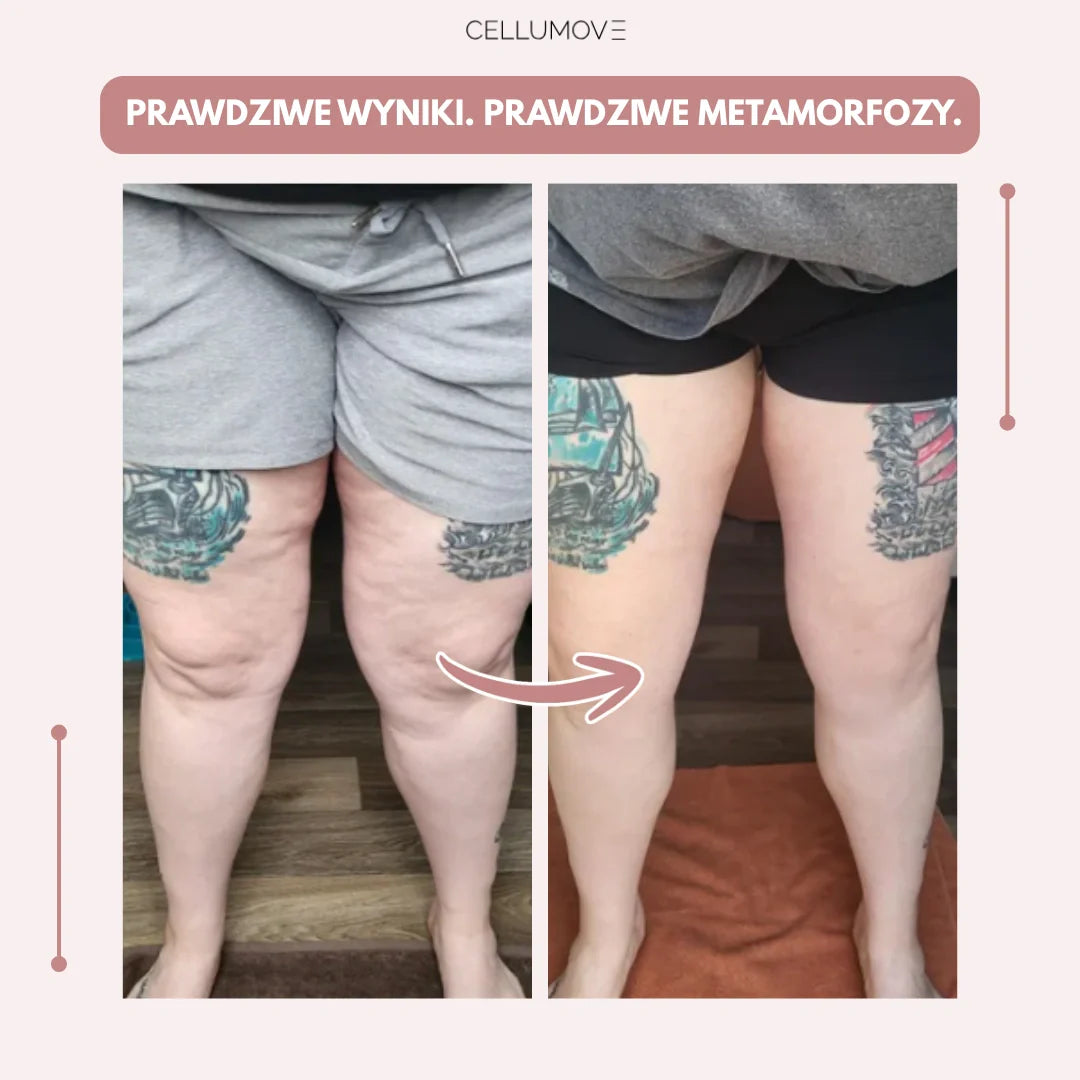 Cellumove 3D Legginsy – Pożegnaj się z bólem i wystąpieniem ekstremalnym w naturalnym sposobie